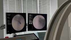 Рентгенохирургические методы лечения применяются в ГКБ №1
